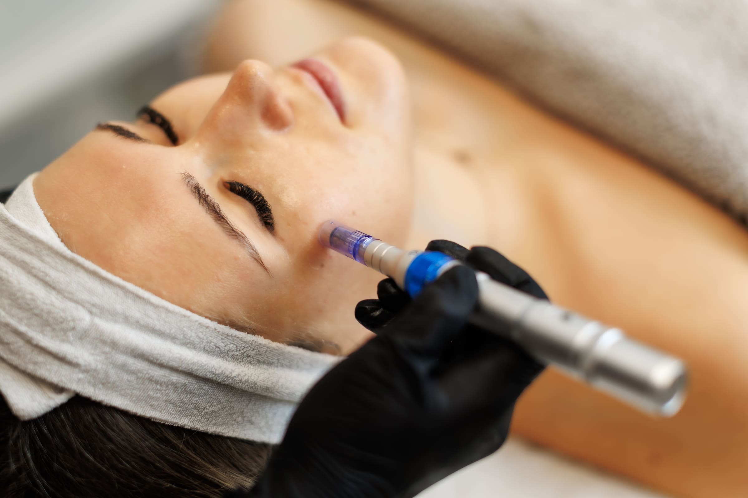 A woman lying back with her eyes closed while a gloved clinician treats her cheek with a microneedling pen