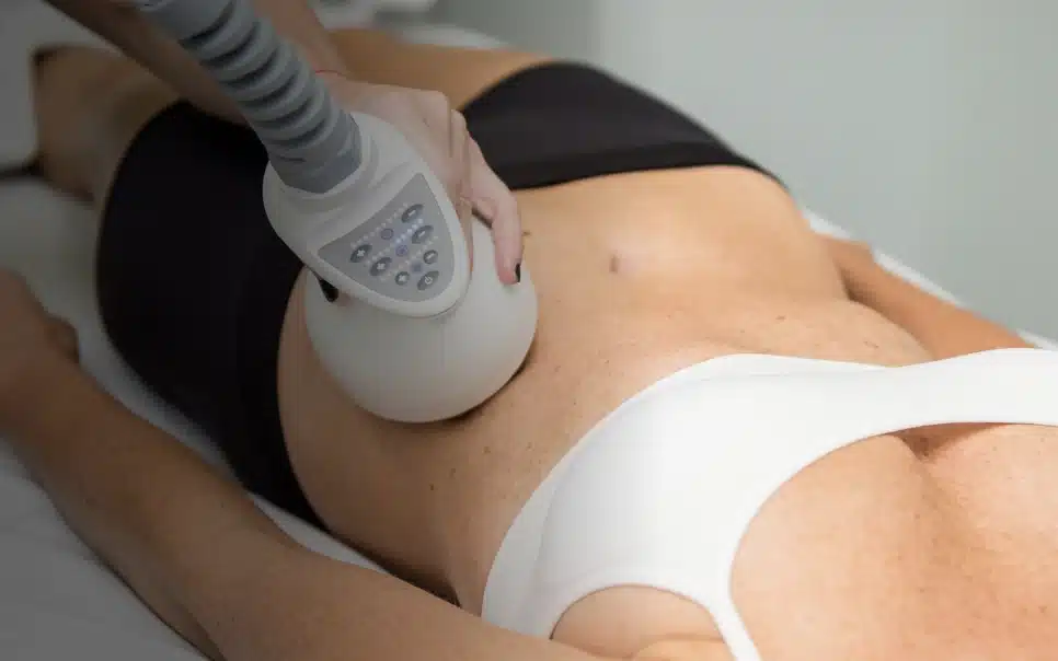 Female patient receiving Venus Legacy treatment on her abdomen