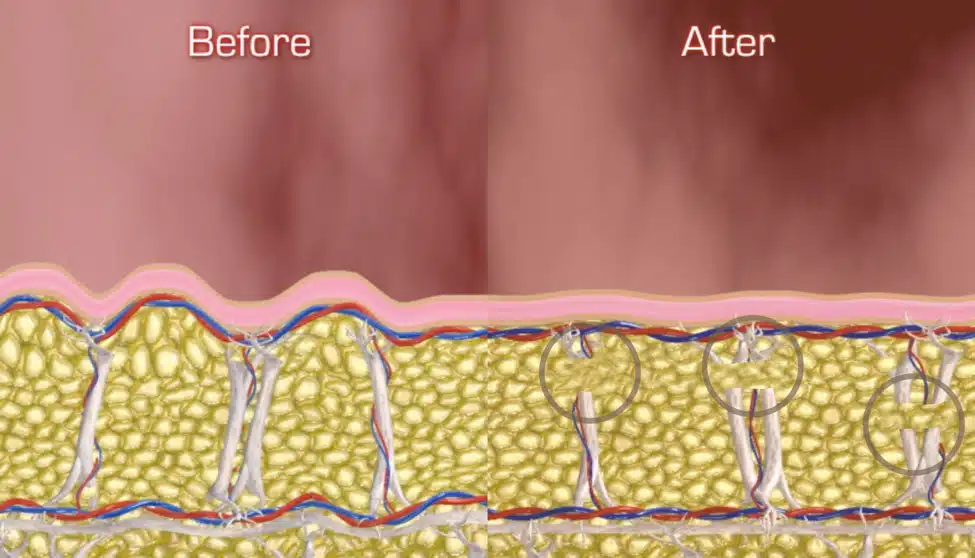 Illustration of smooth skin appearance